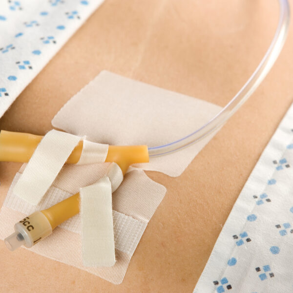 CATH-SECURE Dual Tab Multi-Purpose Tube Anchoring Device